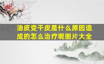 油皮变干皮是什么原因造成的怎么治疗呢图片大全