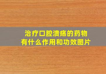 治疗口腔溃疡的药物有什么作用和功效图片