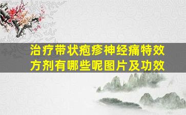 治疗带状疱疹神经痛特效方剂有哪些呢图片及功效