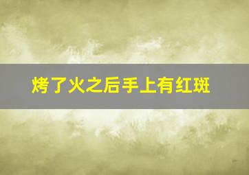 烤了火之后手上有红斑