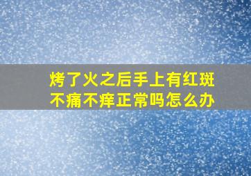 烤了火之后手上有红斑不痛不痒正常吗怎么办