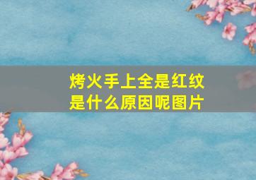 烤火手上全是红纹是什么原因呢图片