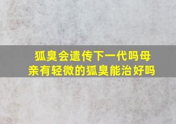 狐臭会遗传下一代吗母亲有轻微的狐臭能治好吗