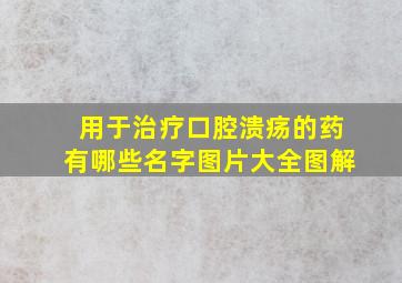 用于治疗口腔溃疡的药有哪些名字图片大全图解