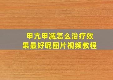 甲亢甲减怎么治疗效果最好呢图片视频教程