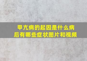 甲亢病的起因是什么病后有哪些症状图片和视频