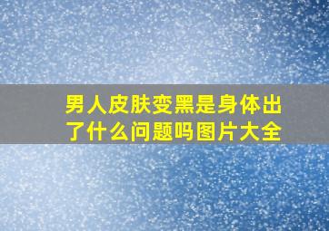 男人皮肤变黑是身体出了什么问题吗图片大全