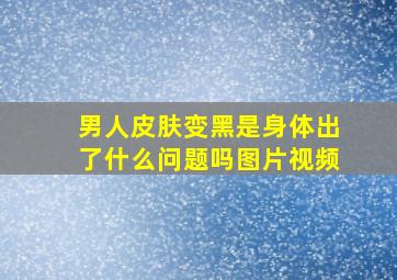 男人皮肤变黑是身体出了什么问题吗图片视频