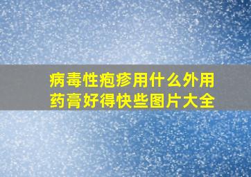 病毒性疱疹用什么外用药膏好得快些图片大全