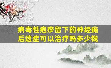 病毒性疱疹留下的神经痛后遗症可以治疗吗多少钱