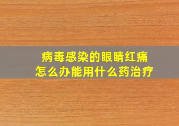 病毒感染的眼睛红痛怎么办能用什么药治疗