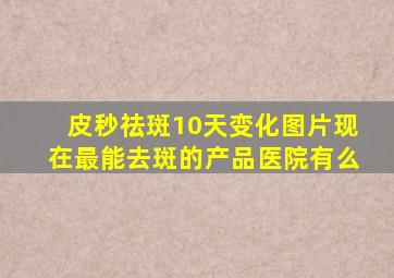 皮秒祛斑10天变化图片现在最能去斑的产品医院有么