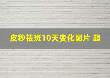 皮秒祛斑10天变化图片 超