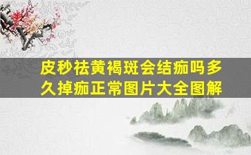 皮秒祛黄褐斑会结痂吗多久掉痂正常图片大全图解