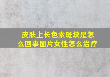 皮肤上长色素斑块是怎么回事图片女性怎么治疗