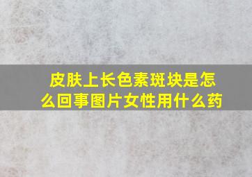 皮肤上长色素斑块是怎么回事图片女性用什么药