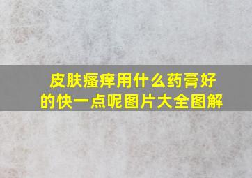 皮肤瘙痒用什么药膏好的快一点呢图片大全图解