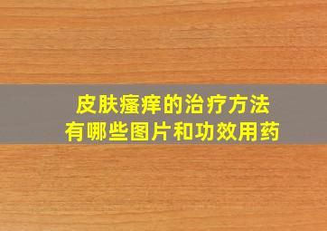 皮肤瘙痒的治疗方法有哪些图片和功效用药