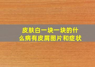 皮肤白一块一块的什么病有皮屑图片和症状