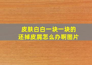 皮肤白白一块一块的还掉皮屑怎么办啊图片