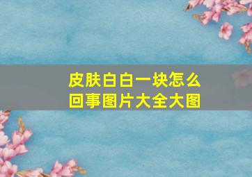 皮肤白白一块怎么回事图片大全大图