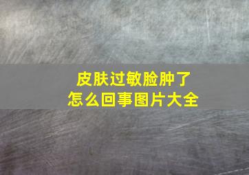 皮肤过敏脸肿了怎么回事图片大全