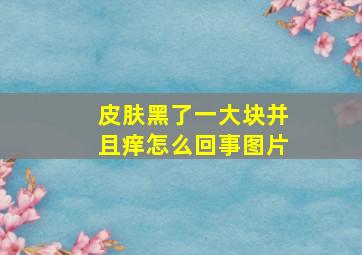 皮肤黑了一大块并且痒怎么回事图片