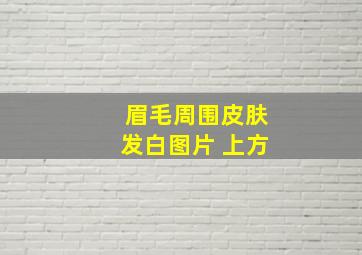 眉毛周围皮肤发白图片 上方