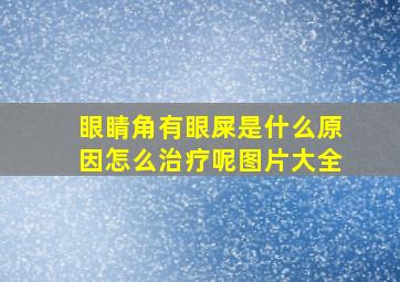 眼睛角有眼屎是什么原因怎么治疗呢图片大全