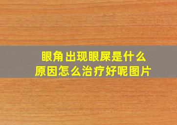 眼角出现眼屎是什么原因怎么治疗好呢图片