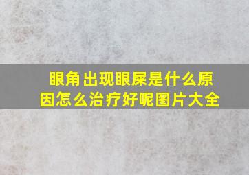 眼角出现眼屎是什么原因怎么治疗好呢图片大全