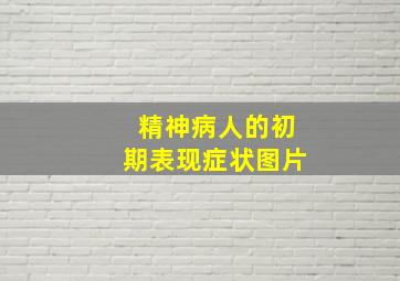 精神病人的初期表现症状图片