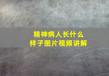 精神病人长什么样子图片视频讲解