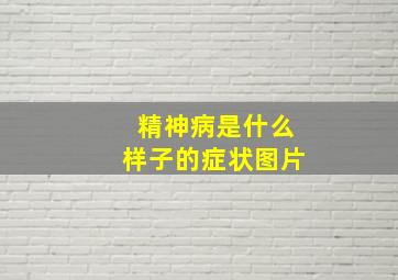 精神病是什么样子的症状图片