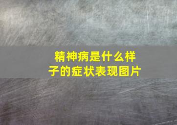 精神病是什么样子的症状表现图片