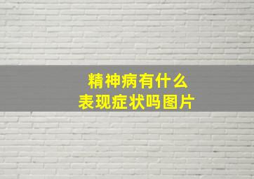 精神病有什么表现症状吗图片