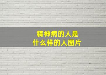 精神病的人是什么样的人图片