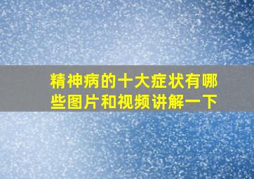 精神病的十大症状有哪些图片和视频讲解一下