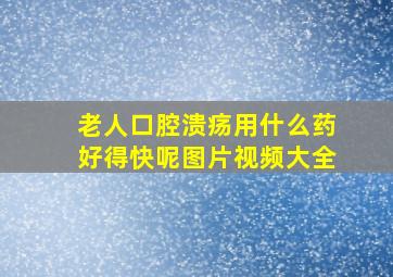 老人口腔溃疡用什么药好得快呢图片视频大全