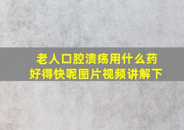 老人口腔溃疡用什么药好得快呢图片视频讲解下