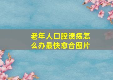 老年人口腔溃疡怎么办最快愈合图片