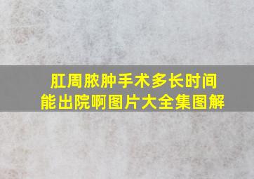 肛周脓肿手术多长时间能出院啊图片大全集图解