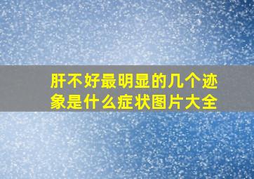 肝不好最明显的几个迹象是什么症状图片大全