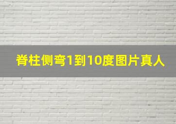 脊柱侧弯1到10度图片真人