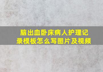 脑出血卧床病人护理记录模板怎么写图片及视频