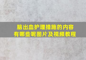 脑出血护理措施的内容有哪些呢图片及视频教程