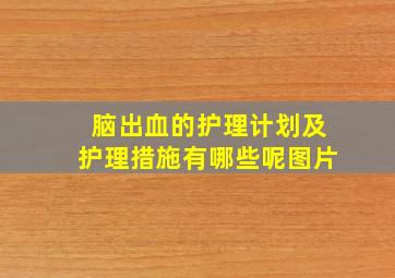 脑出血的护理计划及护理措施有哪些呢图片