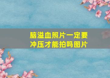 脑溢血照片一定要冲压才能拍吗图片