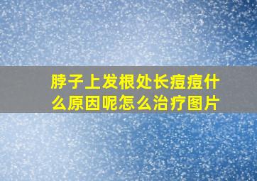 脖子上发根处长痘痘什么原因呢怎么治疗图片