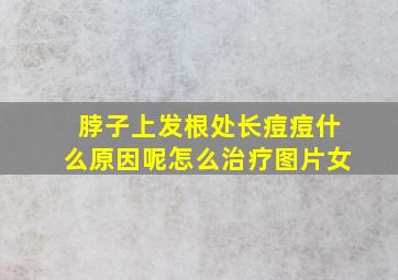 脖子上发根处长痘痘什么原因呢怎么治疗图片女